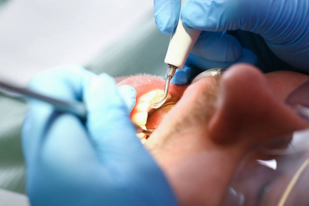 Best Emergency Dentist for Lost Fillings or Crowns in Conway, AR